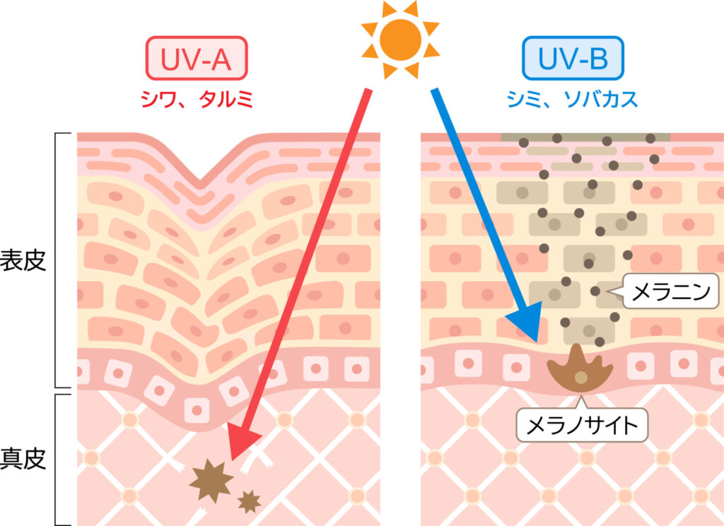 UV-AとUV-Bの影響を現したイラスト